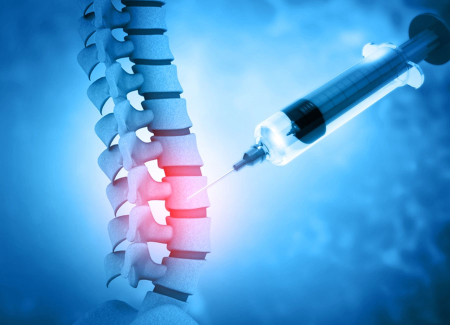 Spinal Injections – Treatments – Dr. Çağrı Canbolat