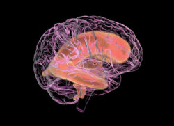 استسقاء الرأس بعد جراحة التحويلة: التعايش مع التحويلة